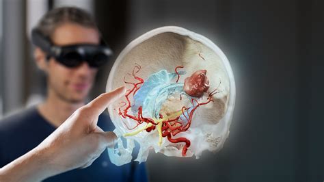 Using Brainlab Magic Leap to Optimize Surgical Workflows